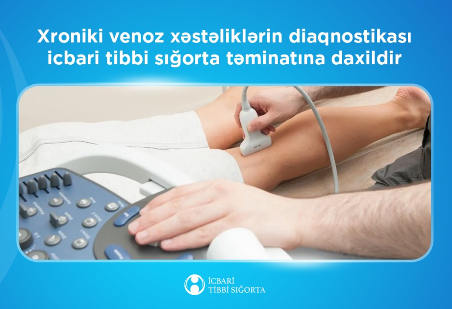 İTSDA: Xroniki venoz xəstəliklərin diaqnostikası icbari tibbi sığorta təminatına daxildir