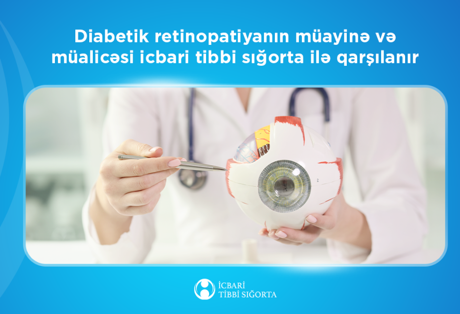 İTSDA: Şəkərli diabeti olan şəxslərdə daimi görmə itkisi yaradan xəstəliyin müayinə və müalicəsi icbari tibbi sığorta ilə qarşılanır