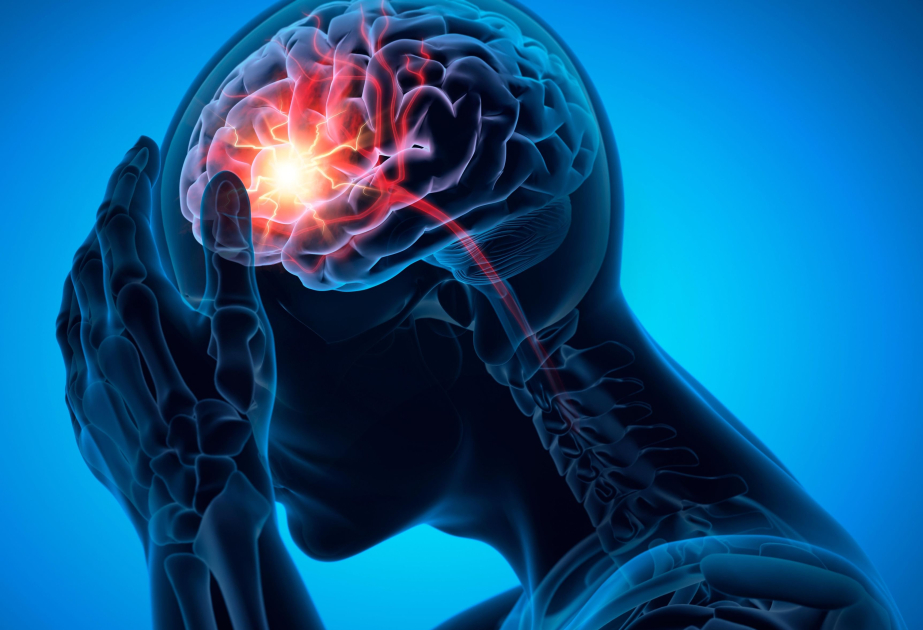Stem cell therapy restores brain function after stroke