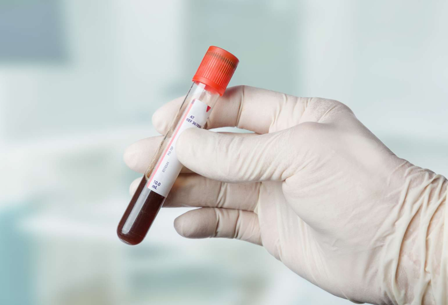 A single blood test can measure how different parts of our bodies are aging