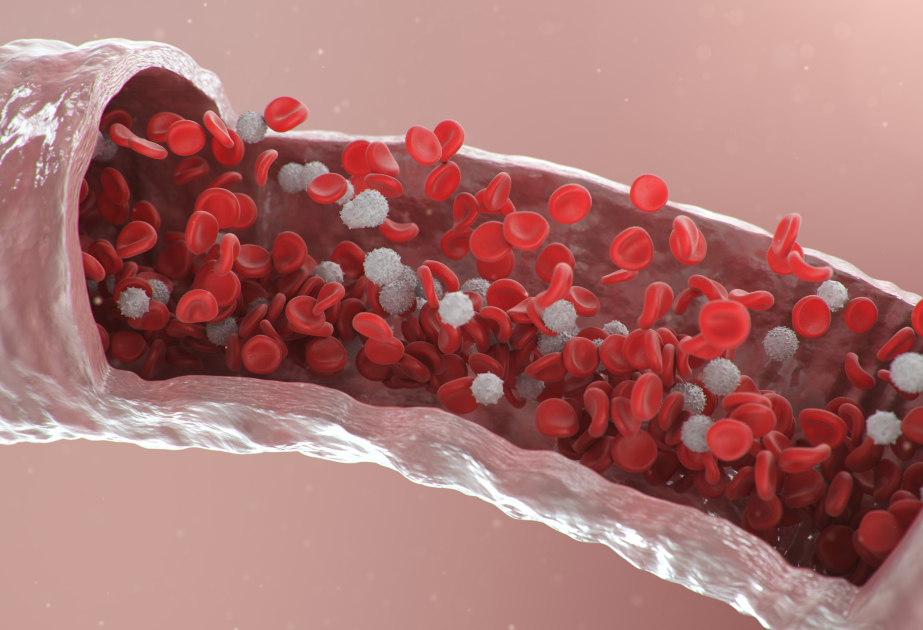 Study finds hidden blood mutations spark obesity, diabetes and liver disease