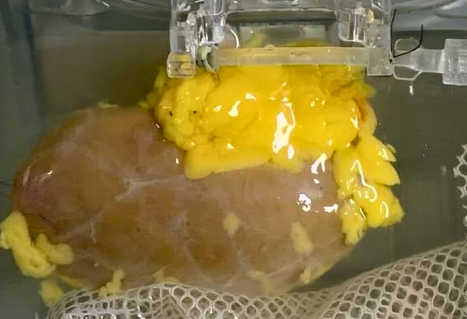 Breakthrough: scientists create ‘universal’ kidney to match any blood type