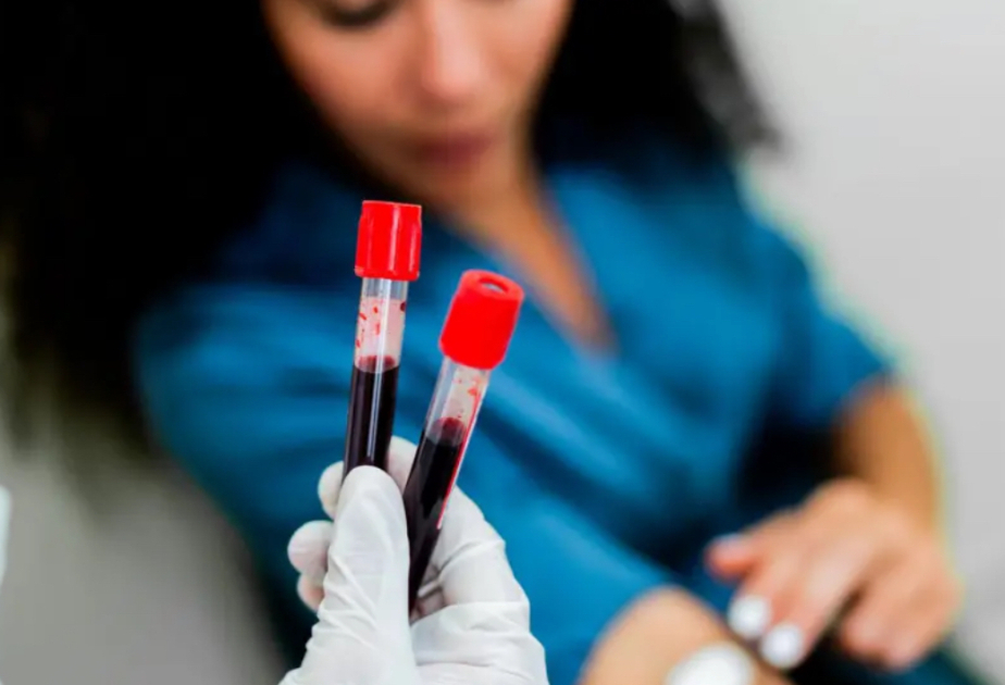 Exciting results from blood test for 50 cancers