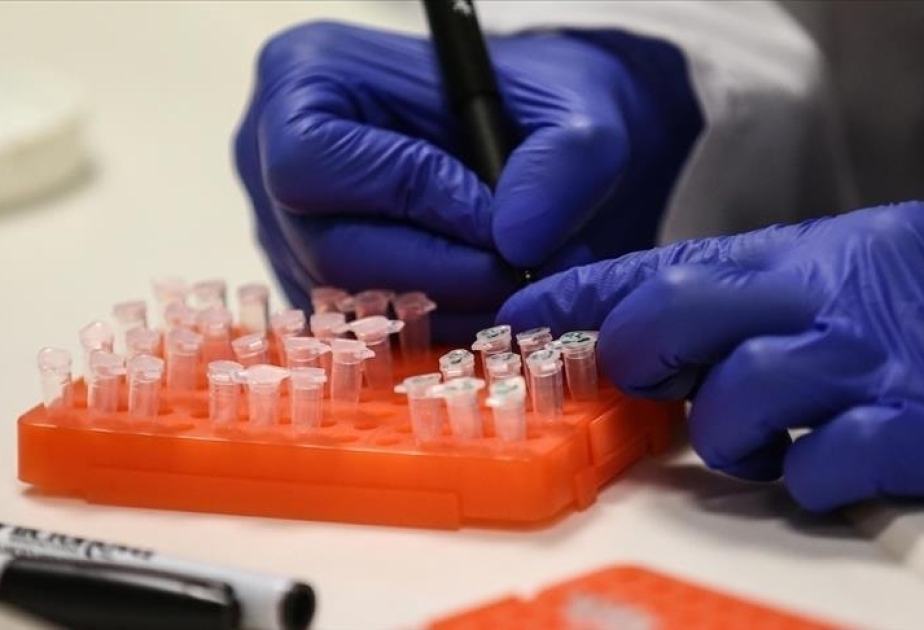 Pays-Bas : le premier cas détecté d’une nouvelle variante du virus de la variole du singe