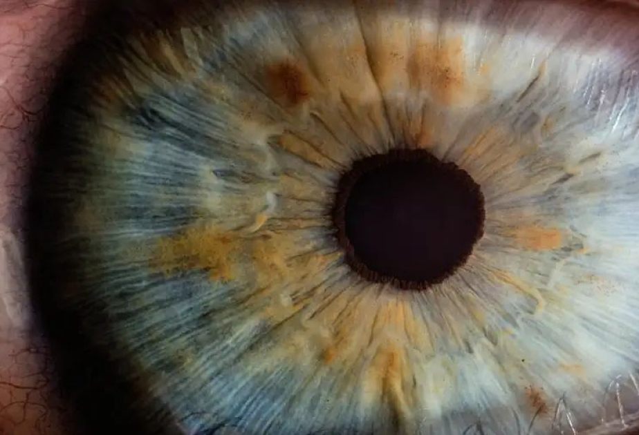 Eye scans reveal clues to aging and heart disease risk, study finds