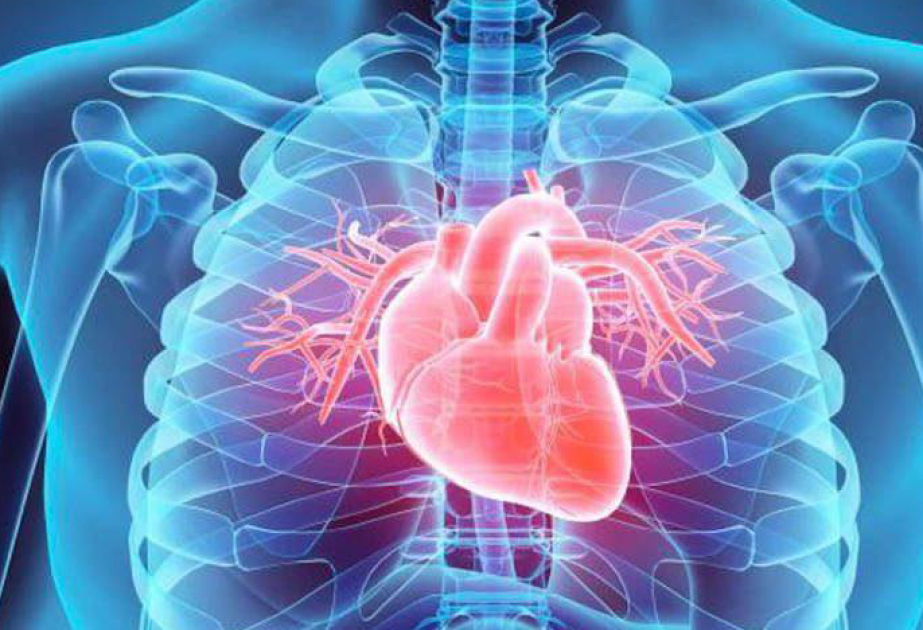 В Швеции резко снизилась смертность от сердечно-сосудистых заболеваний