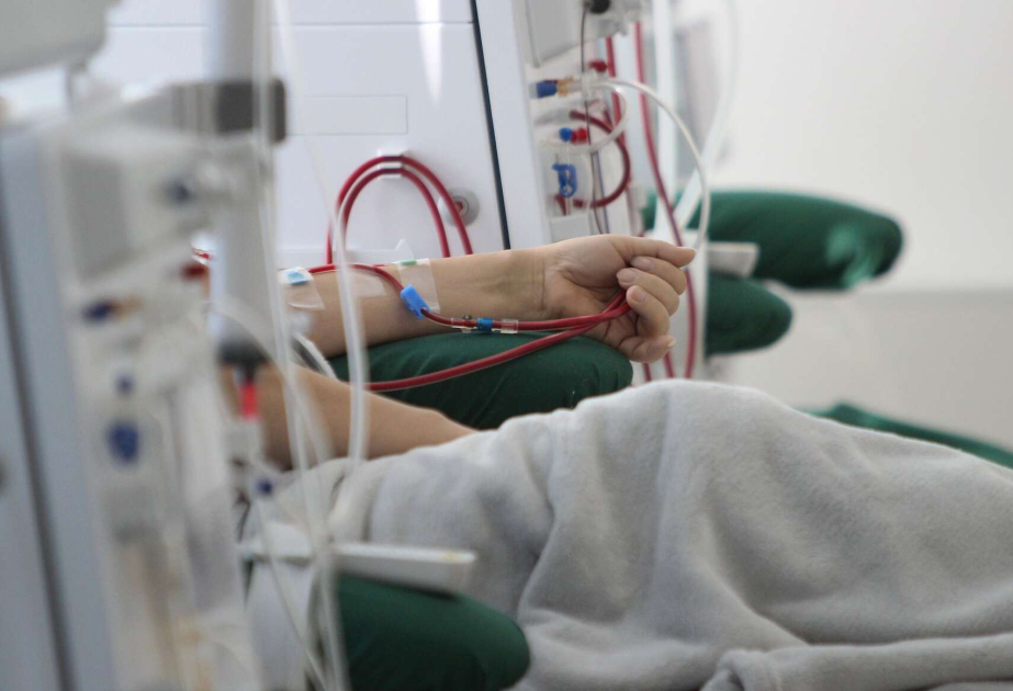 Hazırda Azərbaycanda 9 pasiyent periton dializ müalicəsi alır