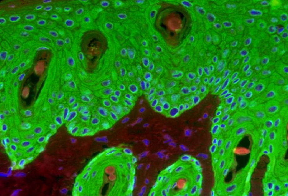 Japanese researchers develop implanted 'living skin' that glows to signal health changes