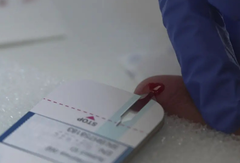 Alzheimer's finger-prick test could help diagnosis
