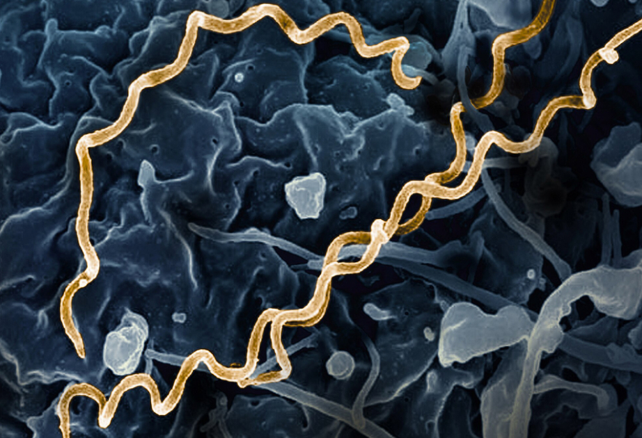 Mit Abstand ältester Syphilis-Erreger entdeckt