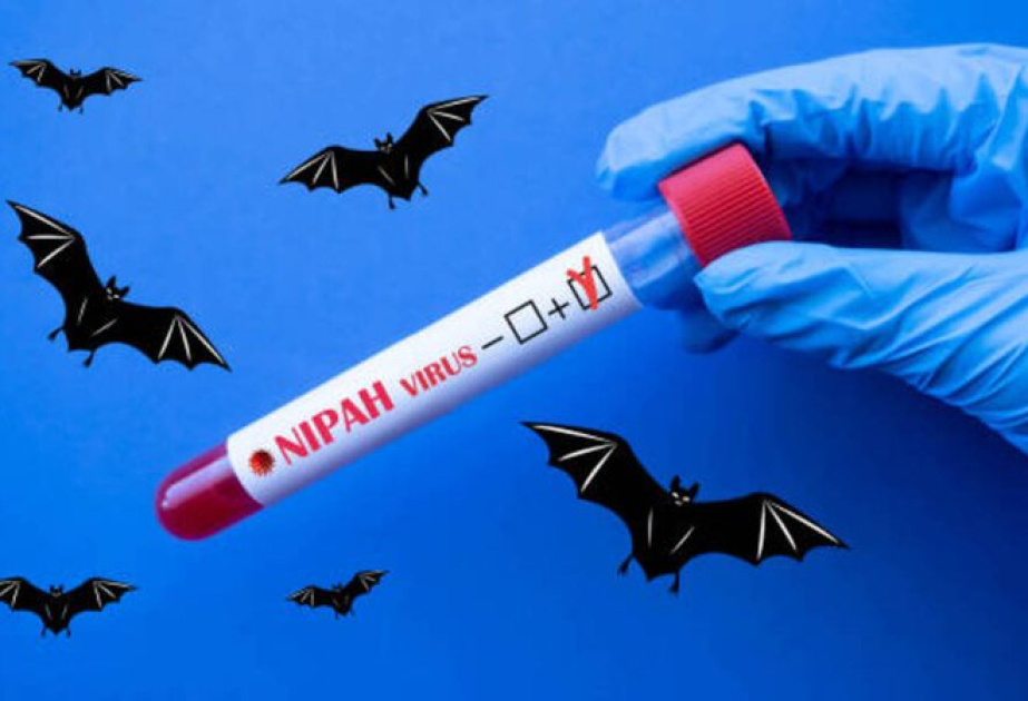 SA at 'no immediate risk' of Nepah virus - Health Department