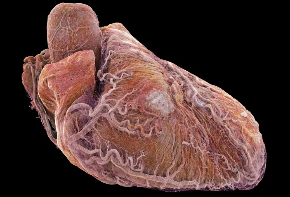 Scientists map human heart in real time during freediving