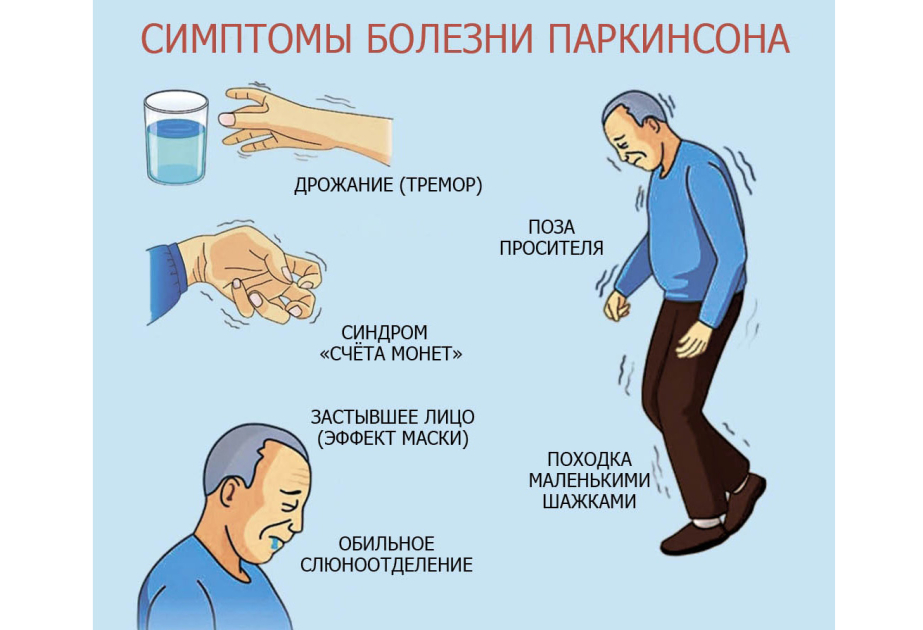 Alimlər Parkinson xəstəliyinin erkən əlamətlərini açıqlayıblar