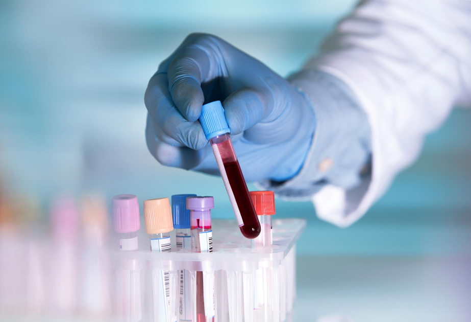 Scientists in Australia develop blood test to predict head, neck cancer relapse