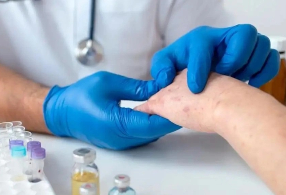 Measles cases up in Almaty