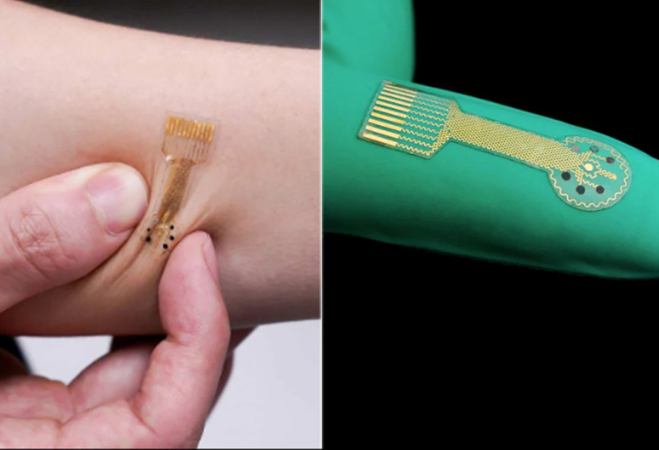 Researchers develop smart bandage for wound monitoring, healing