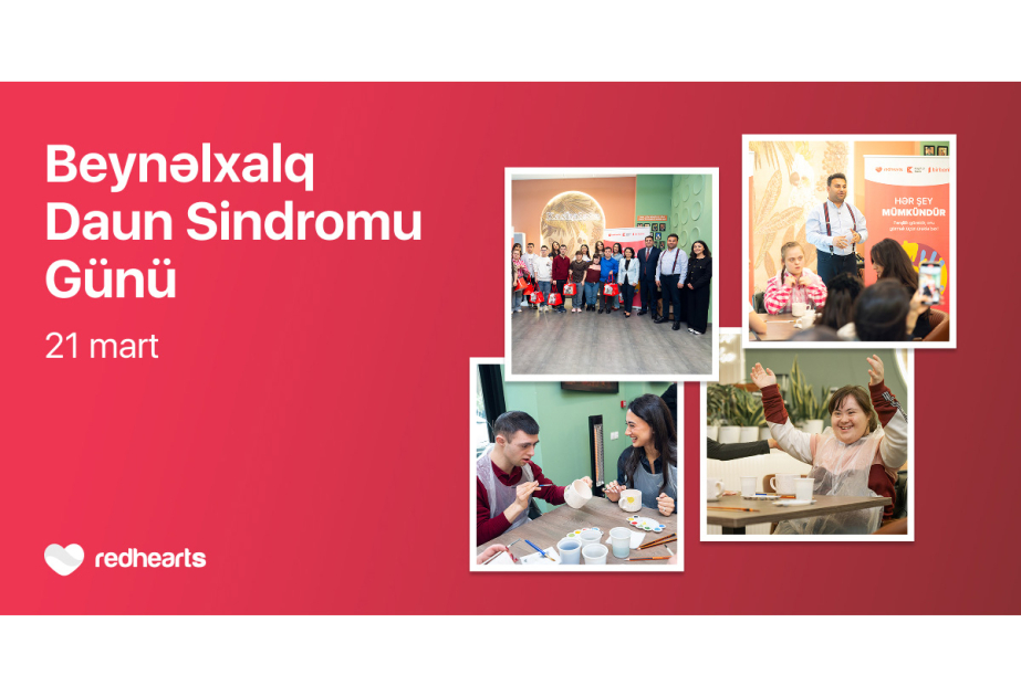 ®  “Hər şey mümkündür”: Master class held to support inclusive development
