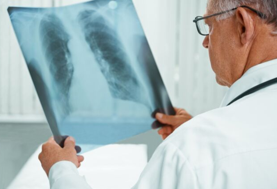 Journée mondiale de lutte contre la tuberculose