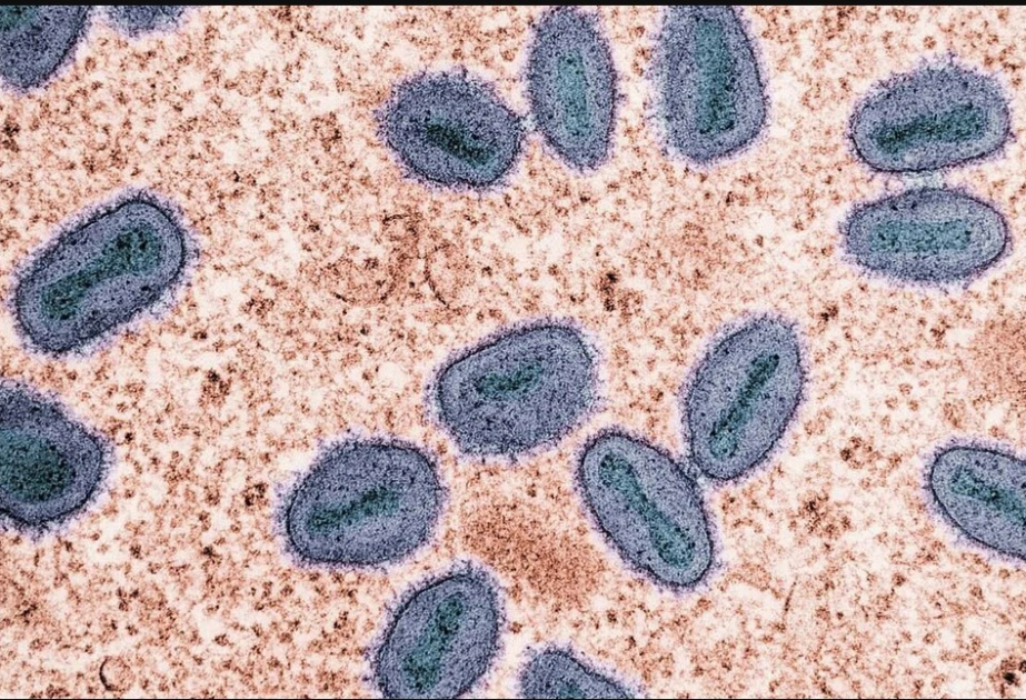 Singapore reports first community mpox cases