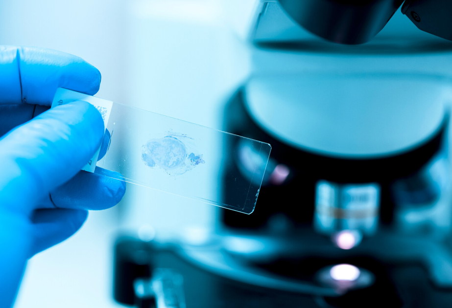 Alimlər məhv olmaqda olan hüceyrələri “diriltməyin” yolunu tapıblar