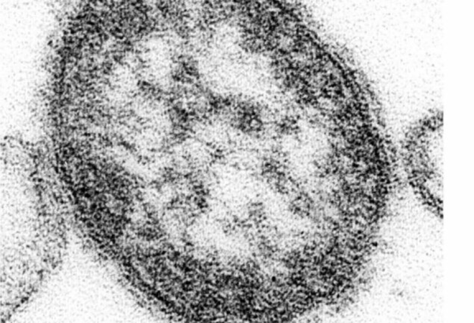 Japan measles cases top 500, nearing 2019 level