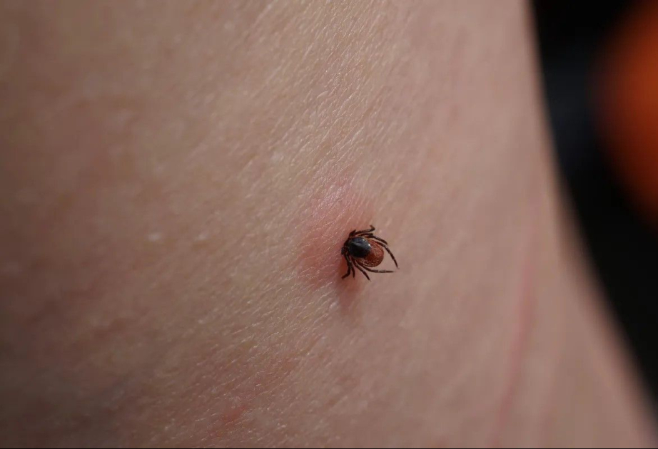 475 tick bite cases recorded in Kazakhstan's Shymkent