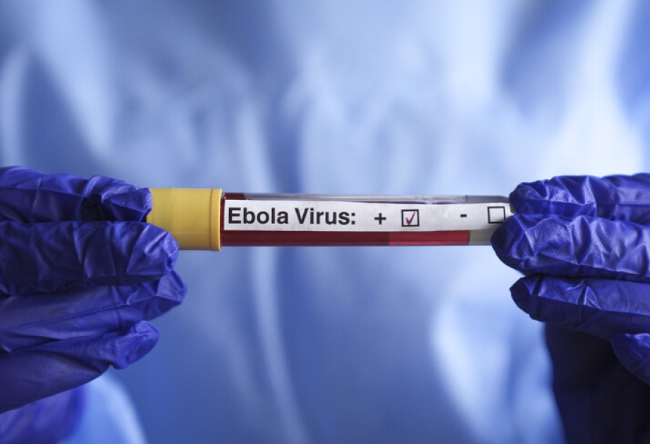 Fransada Ebola həyəcanı: Təsdiqlənmiş yoluxma ilə əlaqədar 5 nəfər təcrid olunub