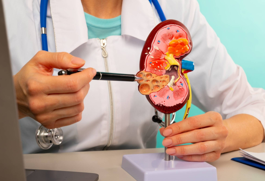 Japan startup to conduct clinical trials of pig kidney transplants