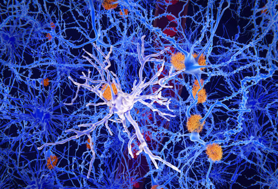 Scientists discover how Alzheimer's may destroy brain cells