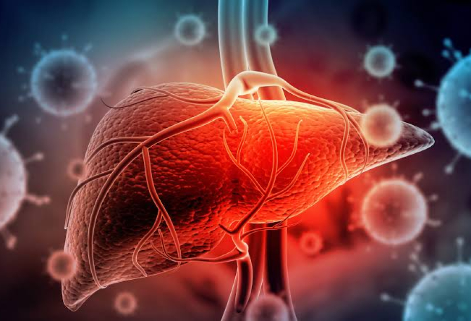 ÜST: Dünyada viral hepatitdən hər gün təqribən 3,5 min nəfər ölür