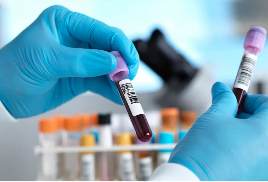 Hepatit C ilə mübarizədə tarixi nəticə: İngiltərə hədəfə vaxtından əvvəl çatıb