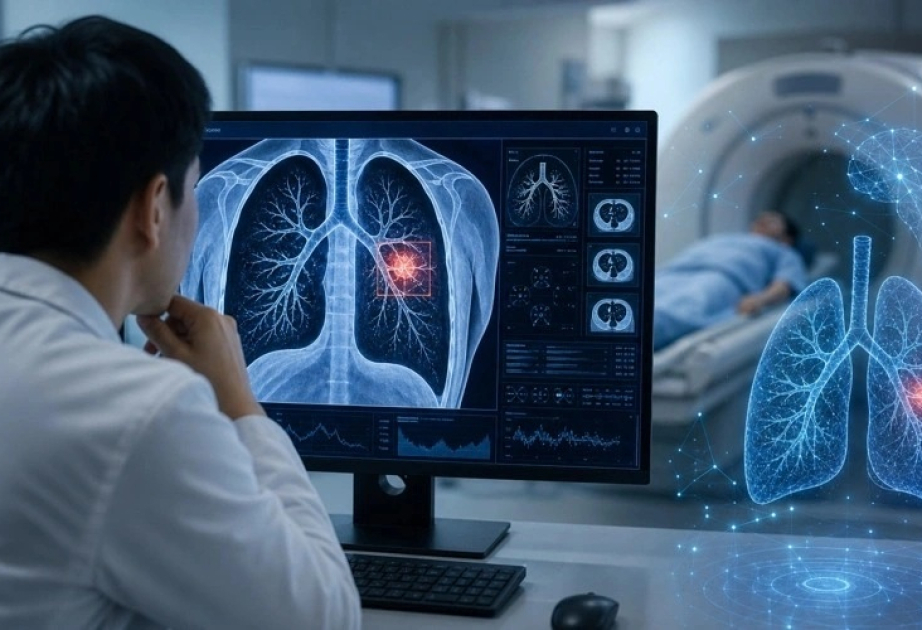 Kazakhstan considers AI for lung cancer detection