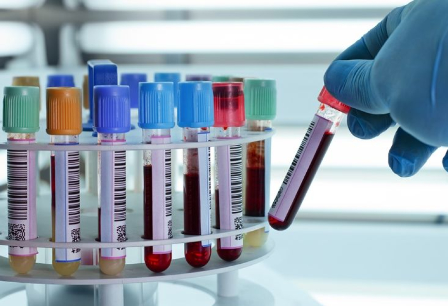 Новый тест крови и новый препарат в лечении рака поджелудочной железы