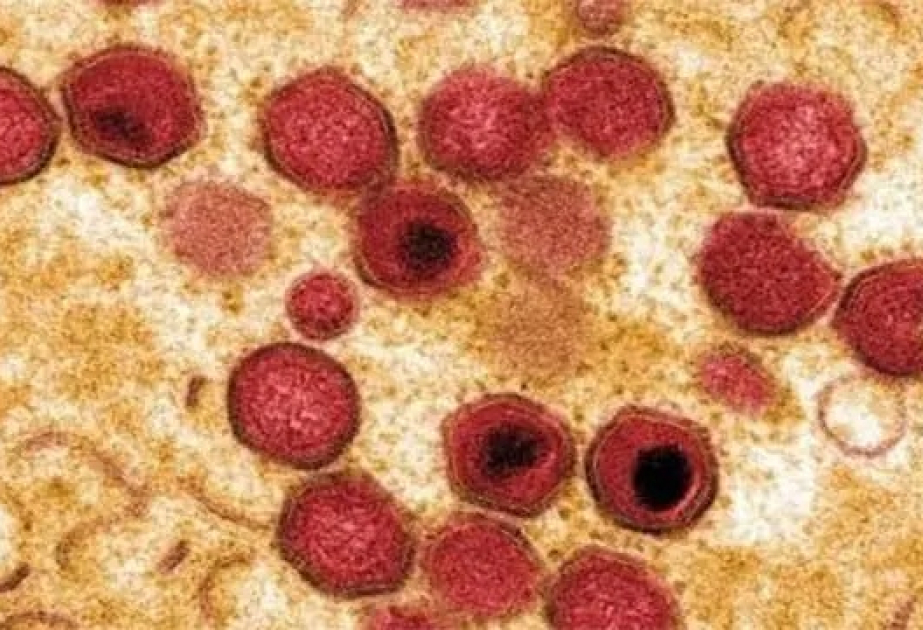 Sri Lanka warns pig farmers as African swine fever resurfaces