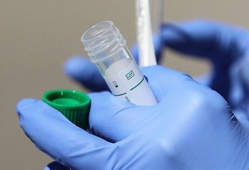 Son sutkada Qırğızıstanda koronavirusdan 9 nəfər ölüb

