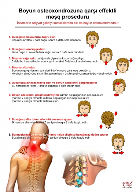 Boyun osteoxondrozuna qarşı effektli məşq proseduru - İNFOQRAFİKA