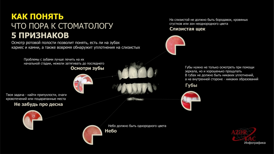 КАК ПОНЯТЬ, ЧТО ПОРА К СТОМАТОЛОГУ – ИНФОГРАФИКА