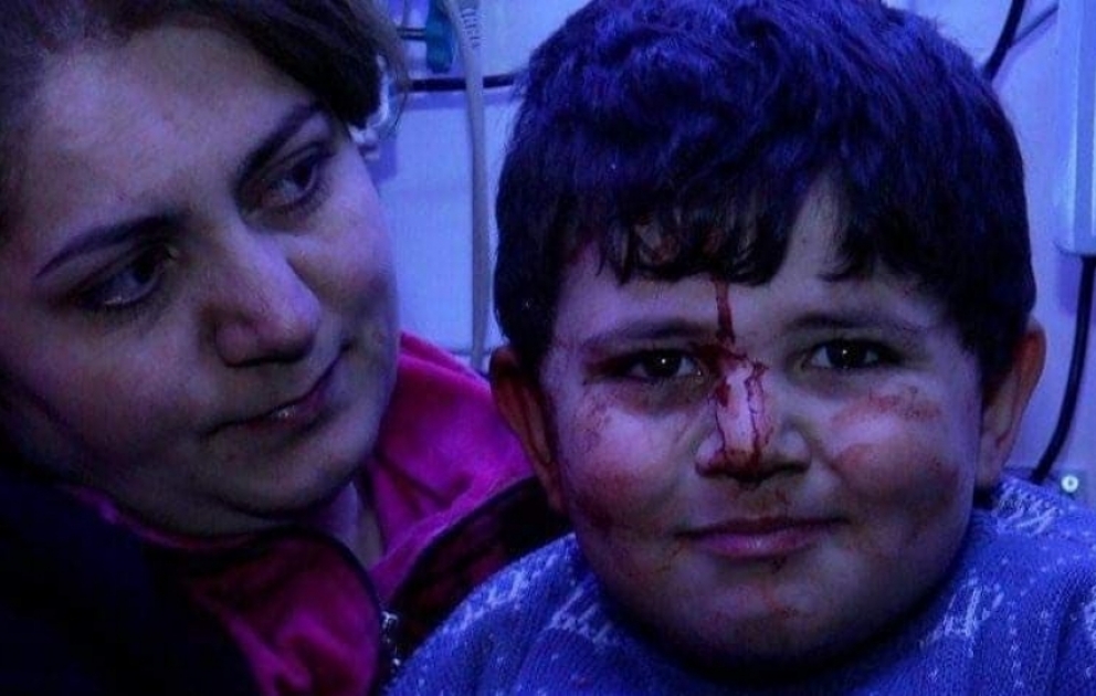 Erməni terrorunun canlı şahidi 6 yaşlı Bəxtiyar: Evimizə bomba düşəndə qorxmadım, heç kişi də qorxar?  FOTO VİDEO